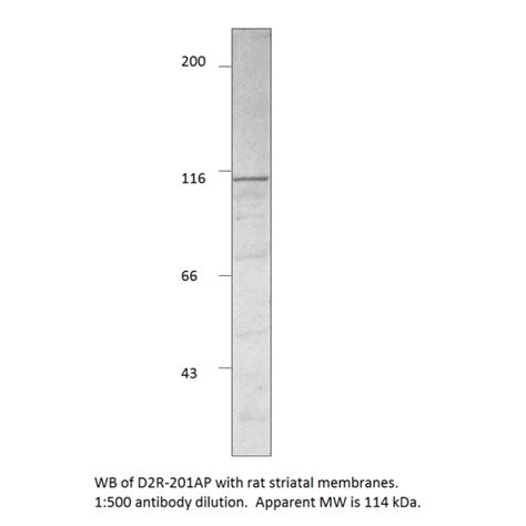 anti dopamine d2 antibody